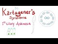 Kartagener's Syndrome (Immotile Cilia Syndrome or Primary Ciliary Dyskinesia) | Pulmonology