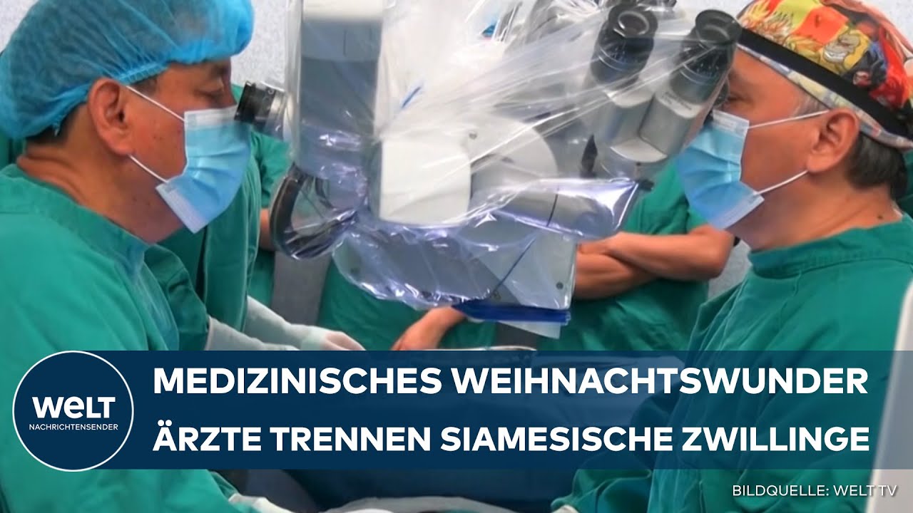 PERU: Weihnachtswunder im Krankenhaus - Ärzte trennen siamesische Zwillinge erfolgreich!