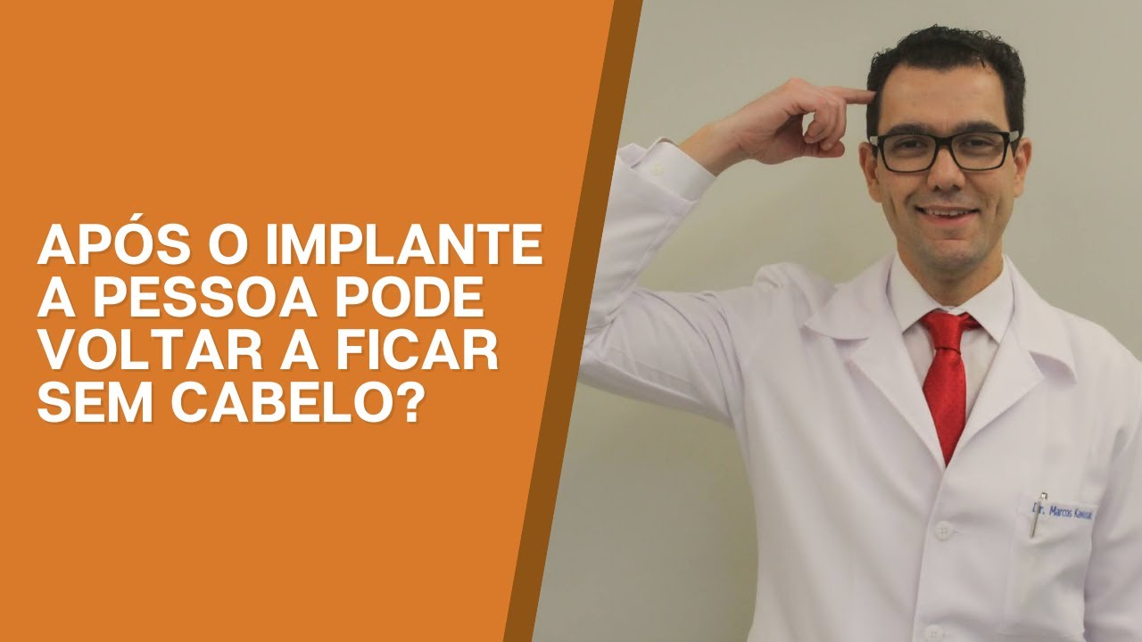 O cabelo pode voltar a cair após o transplante capilar?