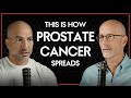 Prostate Cancer And How It Spreads Peter Attia Ted Schaeffer