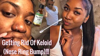 HOW TO GET RID OF A KELOID NOSE RING BUMP *INSIDE & OUTSIDE YOUR NOSE* (EASY TO FOLLOW STEPS!!!)