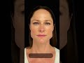 Botox For Facial Slimming Before And After MUST WATCH