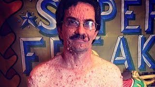 The Real Life Bubble Skin Man – Super Rare Condition