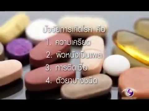 โรคสะเก็ดเงินและหัวใจ สำหรับการเยียวยาชาวบ้าน neurodermatitis