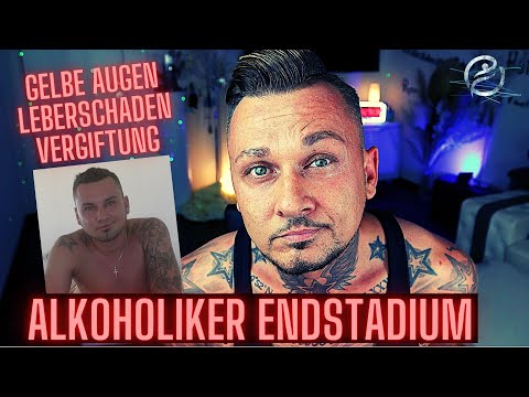 Alcohol addiction damage | my physical decline over time - I tell