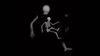 Download lagu wifiskeleton - Nope Your Too Late I Already Died (extended) mp3