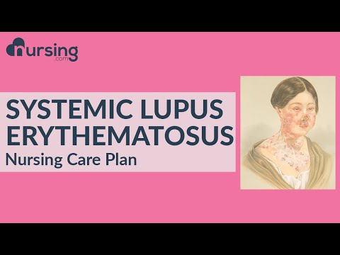 Fogyni lupus, SLE - szisztémás lupus erythematosus