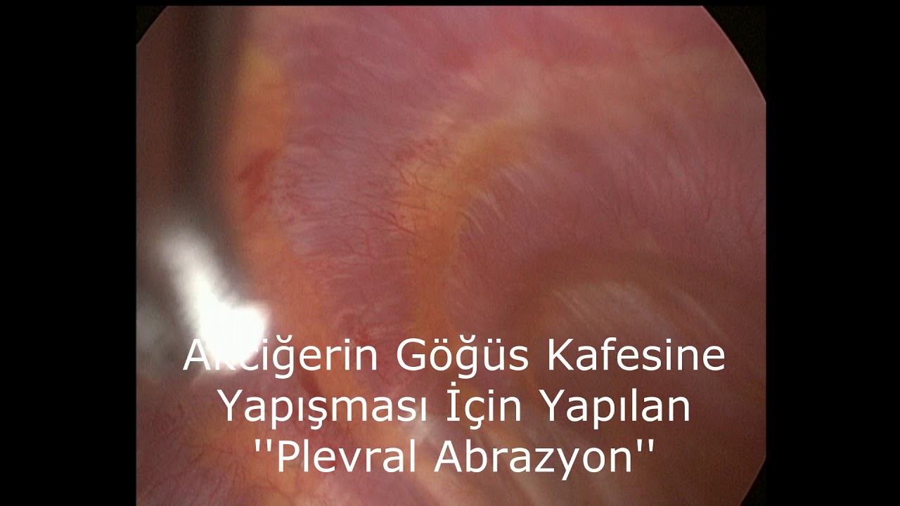 Video Galeri
