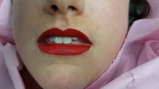 Freshly tattoed Lip Colour Permanent Makeup @ Perfect Definition