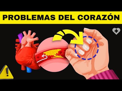 Los 5 principales síntomas de enfermedades cardíacas que tus manos REVELAN