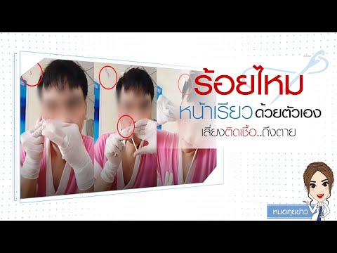 ร้อยไหม หน้าเรียว