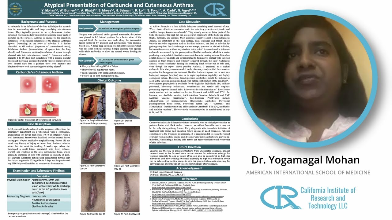 Atypical Presentation of Carbuncle and Cutaneous Anthrax - Dr. Yogamagal Mohan