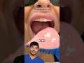 How to Make A Dental Mouth Guard !?
