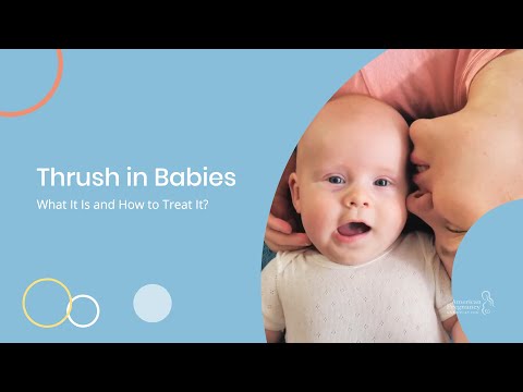 Thrush in Babies—What It Is and How to Treat It 👶🍶