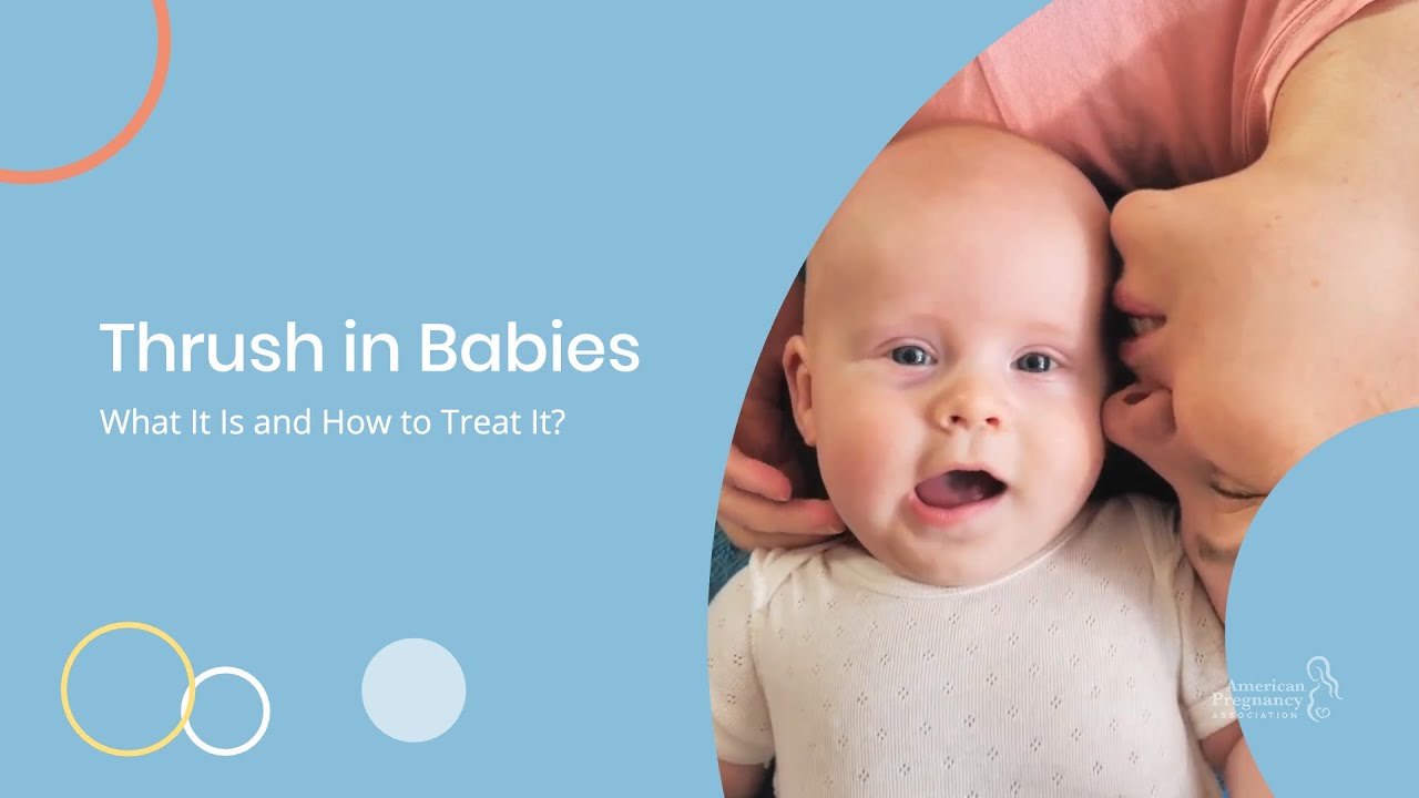 Thrush in Babies—What It Is and How to Treat It 👶🍶