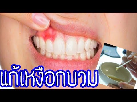 เพิ่มความยาวอวัยวะเพศชาย เมื่อเป็นสมาชิกของการแข็งตัวกลายเป็นน้อย