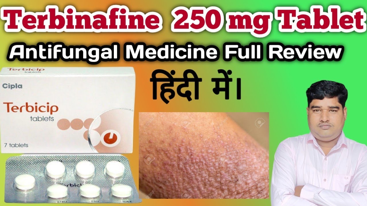 Terbicip Tablets Full Review / Terbinafine / Uses / Benefits / Dose in Hindi.