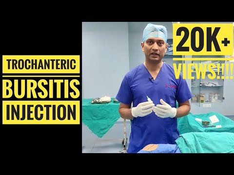 Injection Technique for Trochanteric Bursitis