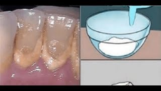 EL ENJUAGUE BUCAL QUE APARTA EL SARRO DE TUS PIEZAS DENTALES Y ELIMINA LA PLACA