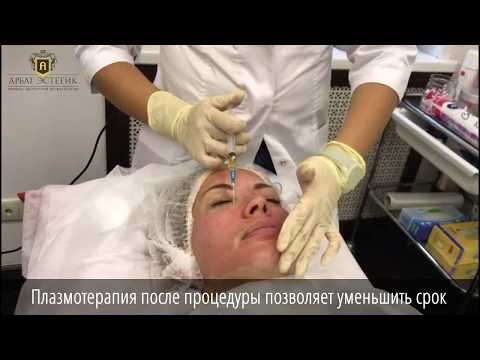 Известные люди с веснушка Мази против пигментных пятен на теле
