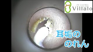 耳掃除動画vol.63「耳垢ののれん」