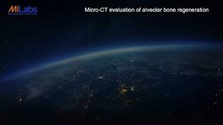 Ultra-high-res CT imaging of drug-induced alveolar bone regeneration