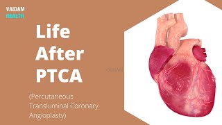 Life After PTCA