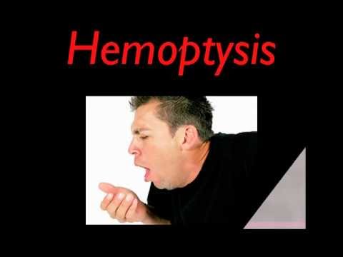 hemoptysis