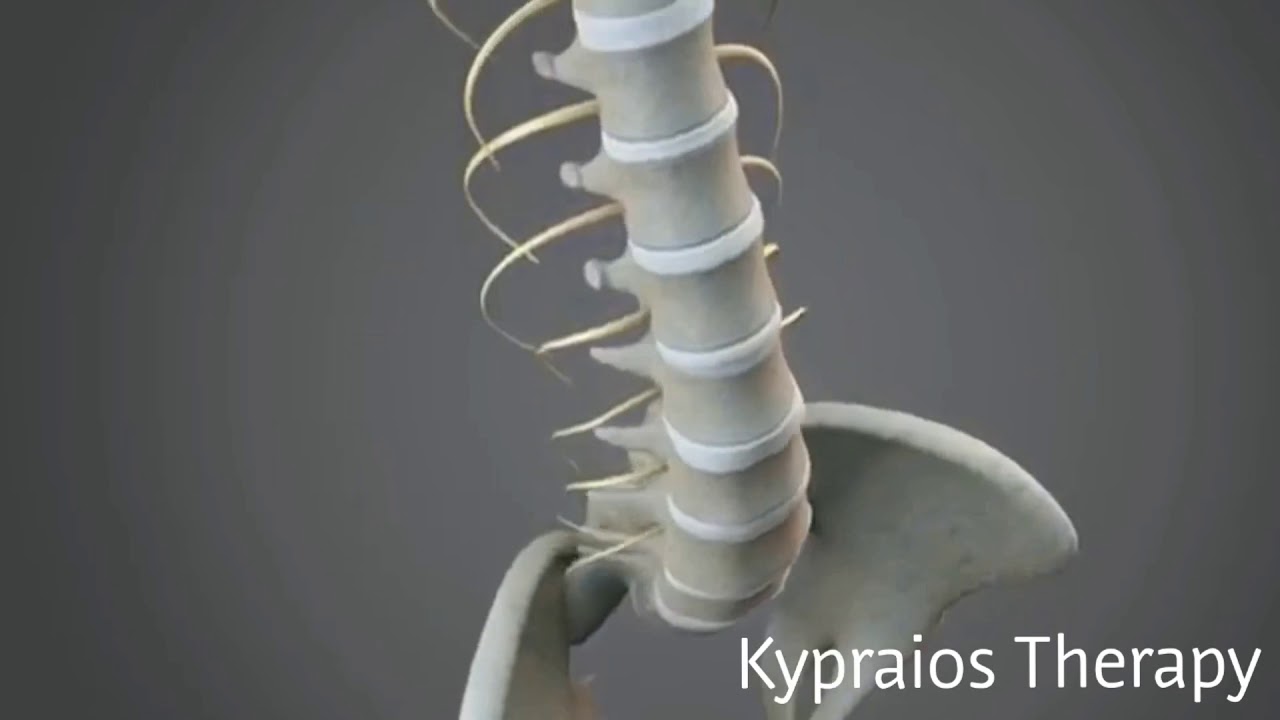 Αποσυμπίεση Σπονδυλικής Στήλης 3D