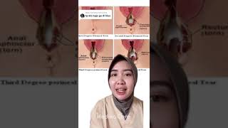 Download lagu Melahirkan dengan robekan tidak dibius? - Medikacare mp3