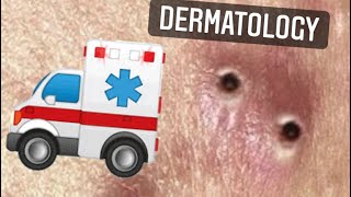 Reddit Dermatology!  Best Pimples and Medical Clips