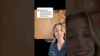 Birthmarks explained!