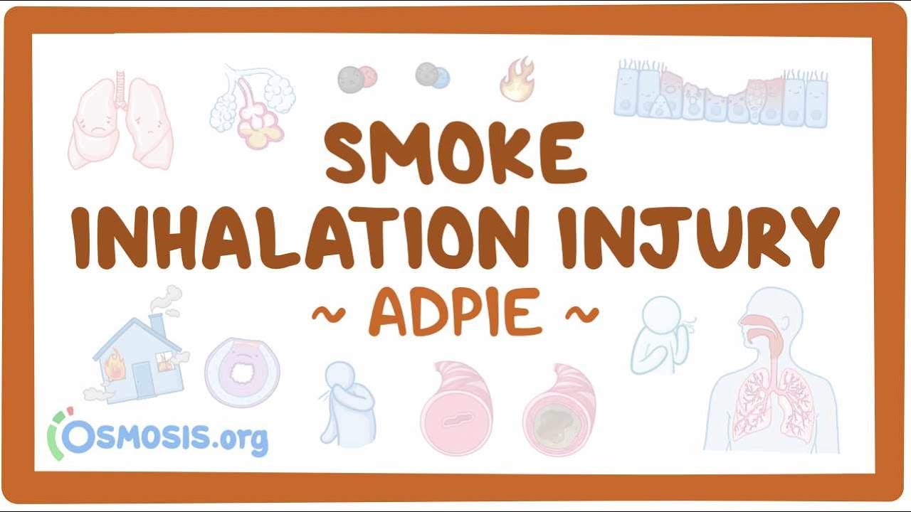 Smoke inhalation injury: Nursing Process (ADPIE)