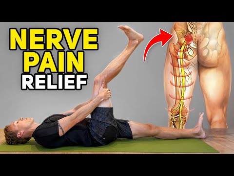 Leg Nerve Pain Exercises (Lumbar Radiculopathy)