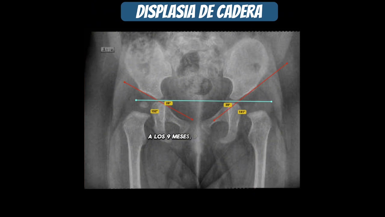 Ruben Sosa Arauco-12