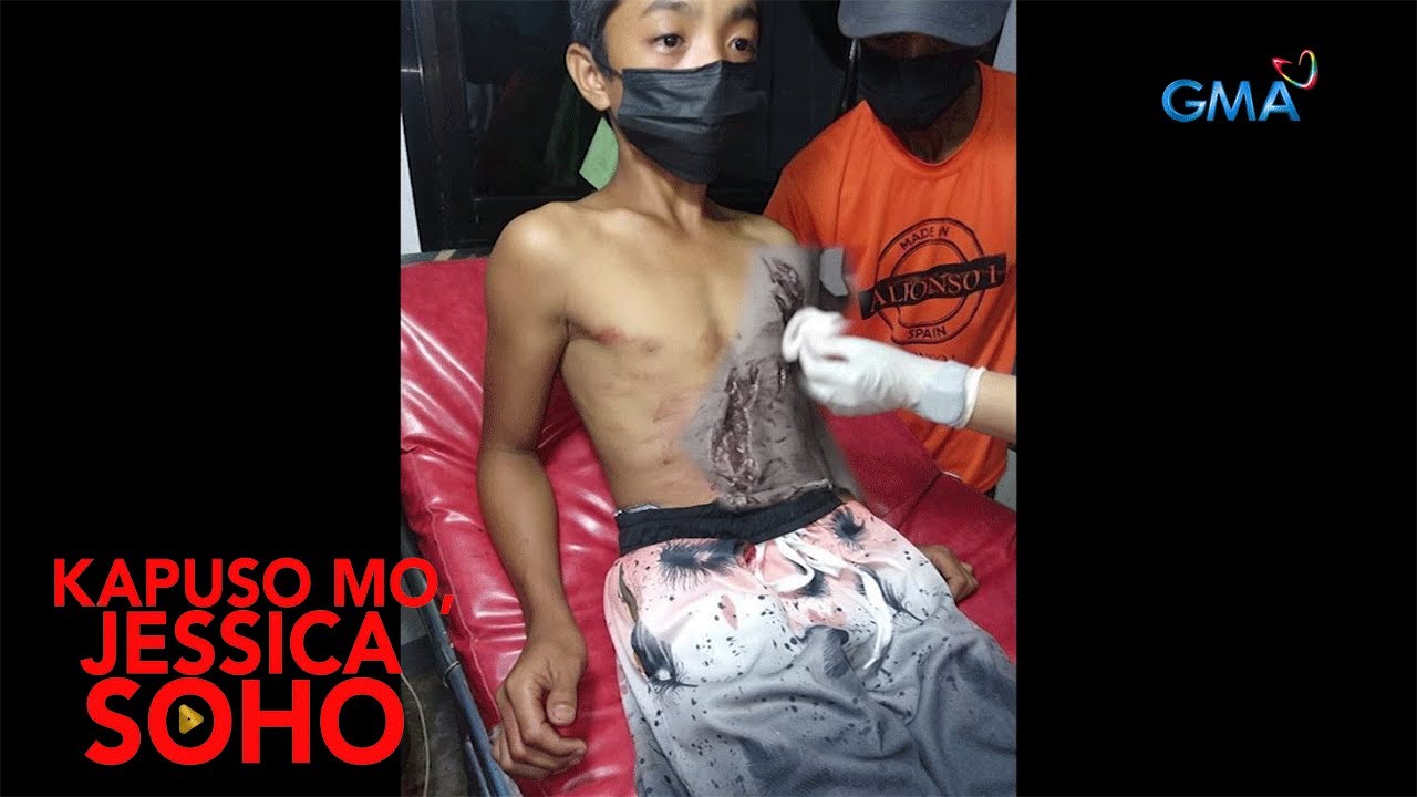 Putar video Kapuso Mo, Jessica Soho: BATA, AKSIDENTENG NALAGARI NG CHAINSAW NG SARILI NIYANG AMA sekarang Kapuso Mo, Jessica Soho: BATA, AKSIDENTENG NALAGARI NG CHAINSAW NG SARILI NIYANG AMA