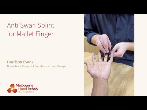 Anti Swan Splint for Mallet Finger