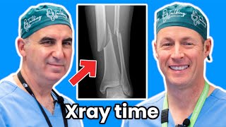 Injured Your Ankle. Do You Need An X-ray?  Here's How To Tell