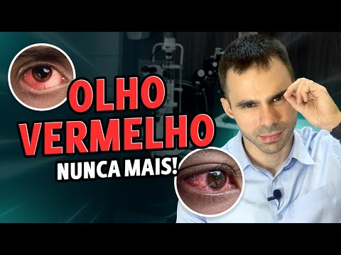 Say Goodbye to Red Eyes! Causes and How to Quickly Solve Redness in the Eyes.