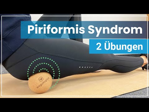 Piriformis Syndrom  - 2 einfache Übungen gegen Deine Schmerzen | Ursachen