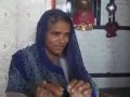 woman removes kidney stone with mouth - YouTube