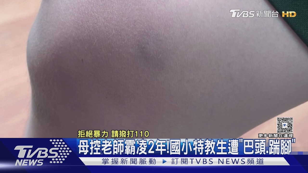 影音/母控老師霸凌兩年! 國小特教生遭「巴頭、踹腳」 僅申誡1支