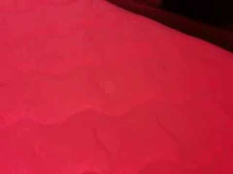 Bed Bugs at Super 8 Motel