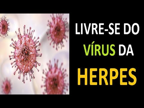 , title : 'Como se LIVRAR do VÍRUS DA HERPES de forma natural ?'