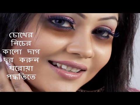 How to Remove black spots in the eye ।। dark circles...