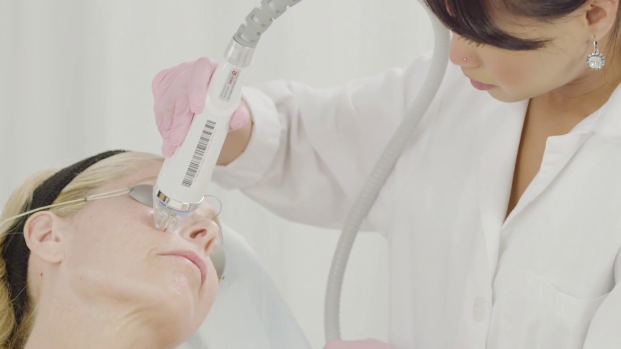 Secret RF Perspectives