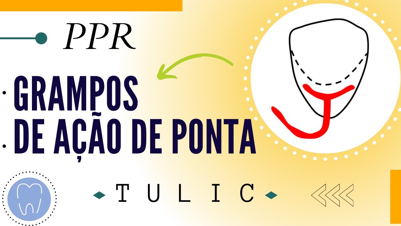 GRAMPOS DE AÇÃO DE PONTA | RETENTORES DIRETOS
