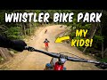 Here S Why Whistler Bike Park Is THE BEST