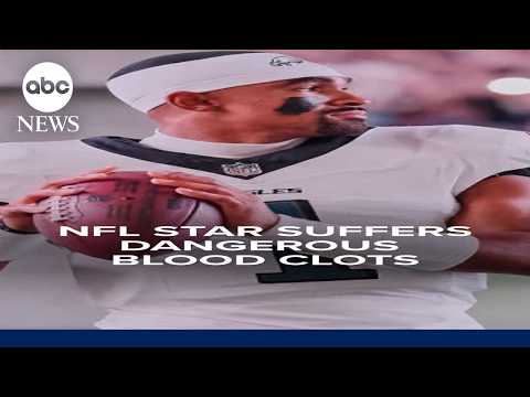 Philadelphia Eagles' Jalen Hurts out for the season over dangerous blood clots