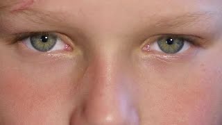 Blinking  Eyes Stock Video